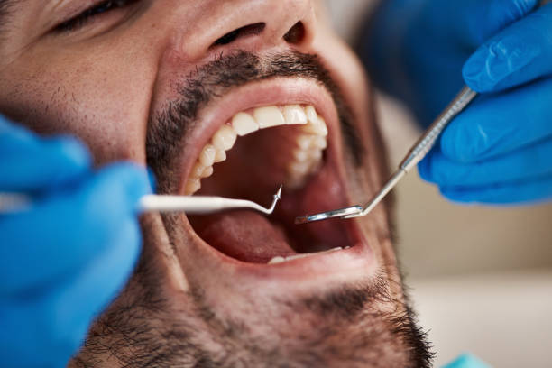 Best Emergency Dental Care for Trauma or Injury in Fort Scott, KS